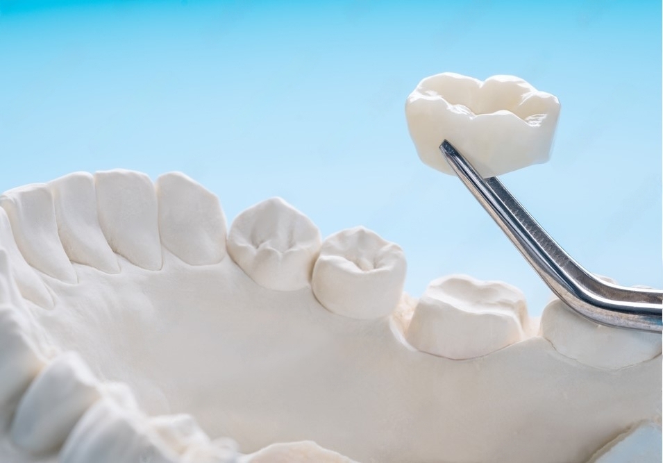 Restorative Dentistry